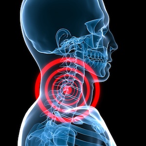 Am oberen Ende der Wirbelsäule steckt viel Bewegung. Schmerzen am Halswirbel.